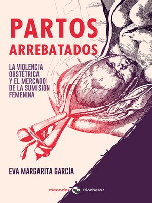 cover image of Partos arrebatados